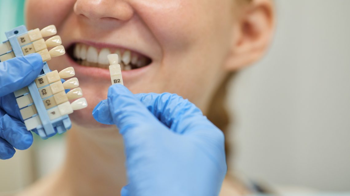 Implantes dentales proceso | ODOS Dental