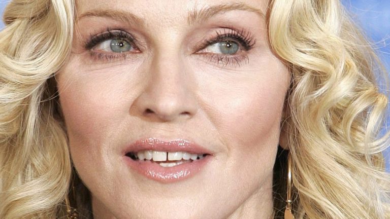 Dientes separados Madonna | ODOS Dental
