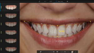 Diseño de Sonrisa Digital (DSD) | ODOS Dental